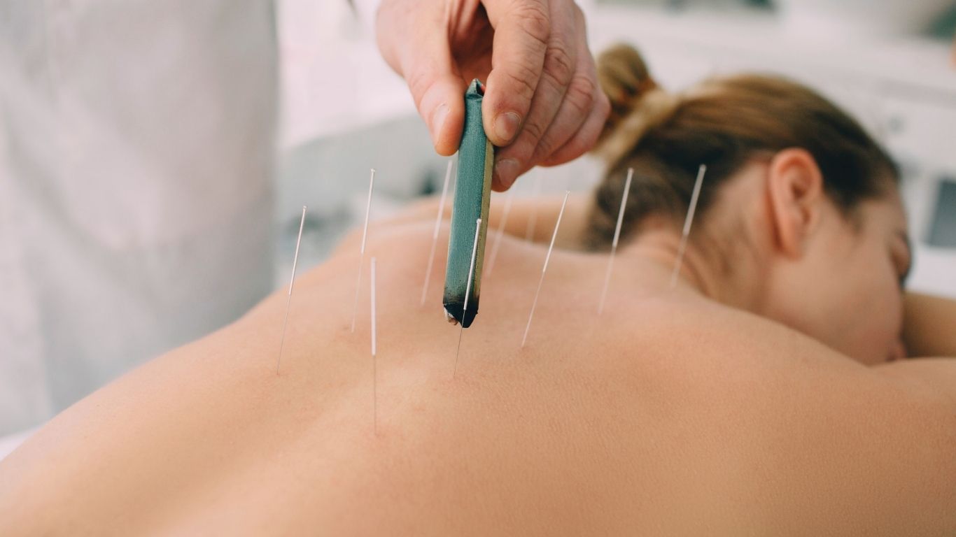 "Can Acupuncture Help Your Restless Leg Syndrome?"